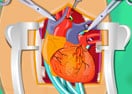 Heart Surgery