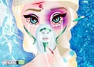 Elsa Head Injury