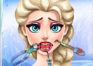 Elsa Tooth Injury