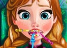 Anna Tooth Injury