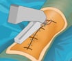 Virtual Knee Surgery