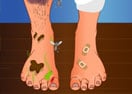 Smelly Feet Surgery