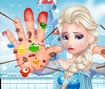 Elsa Hand Doctor