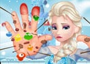 Elsa Hand Doctor