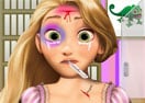 Rapunzel Head Injury