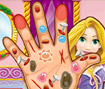 Rapunzel Hand Doctor