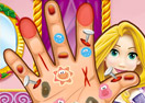 Rapunzel Hand Doctor - Jogos Online