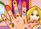 Rapunzel Hand Doctor