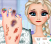 Elsa Foot Injured