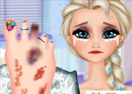 Elsa Foot Injured