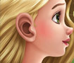 Rapunzel Ear Surgery