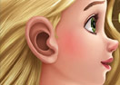 Rapunzel Ear Surgery