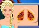 Jogar Elsa Nose Surgery