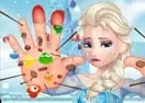 Jogar Elsa Hand Doctor